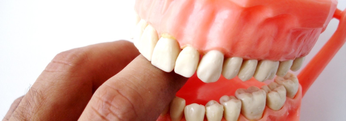 https://www.spto.nl/mondhygienist in apeldoorn